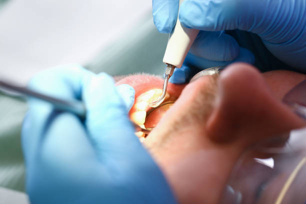 Best Emergency Dental Care for Broken or Chipped Teeth in Garden Home Whitfd, OR